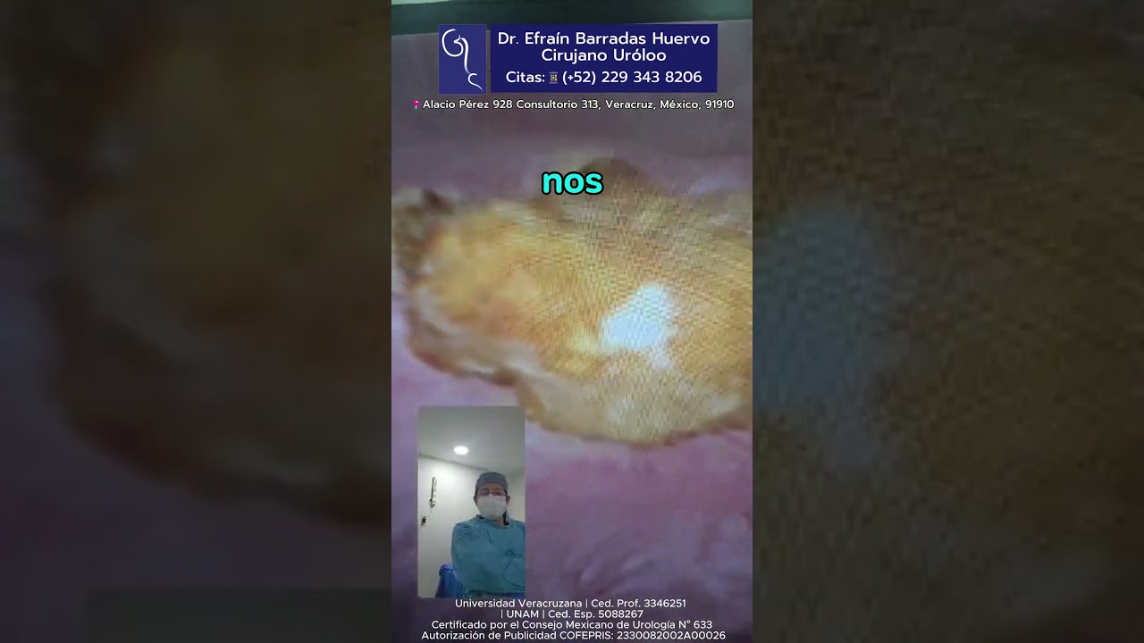 Efrain Barradas Huervo-48