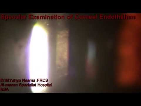 specular examination of corneal endothelium by slit lamp Video