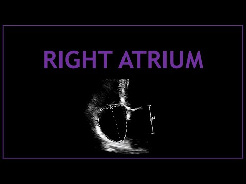 Right Atrium! (Echocardiography)