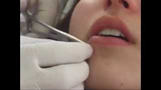 Getting my lip piercing done ♥