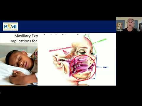 Kevin Boyd, DDS does a virtual presentation  " Maxillary Expansion in the Primary Dentition."