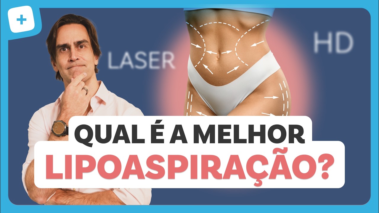 LIPOASPIRAÇÃO: como é feita, tipos e recuperação