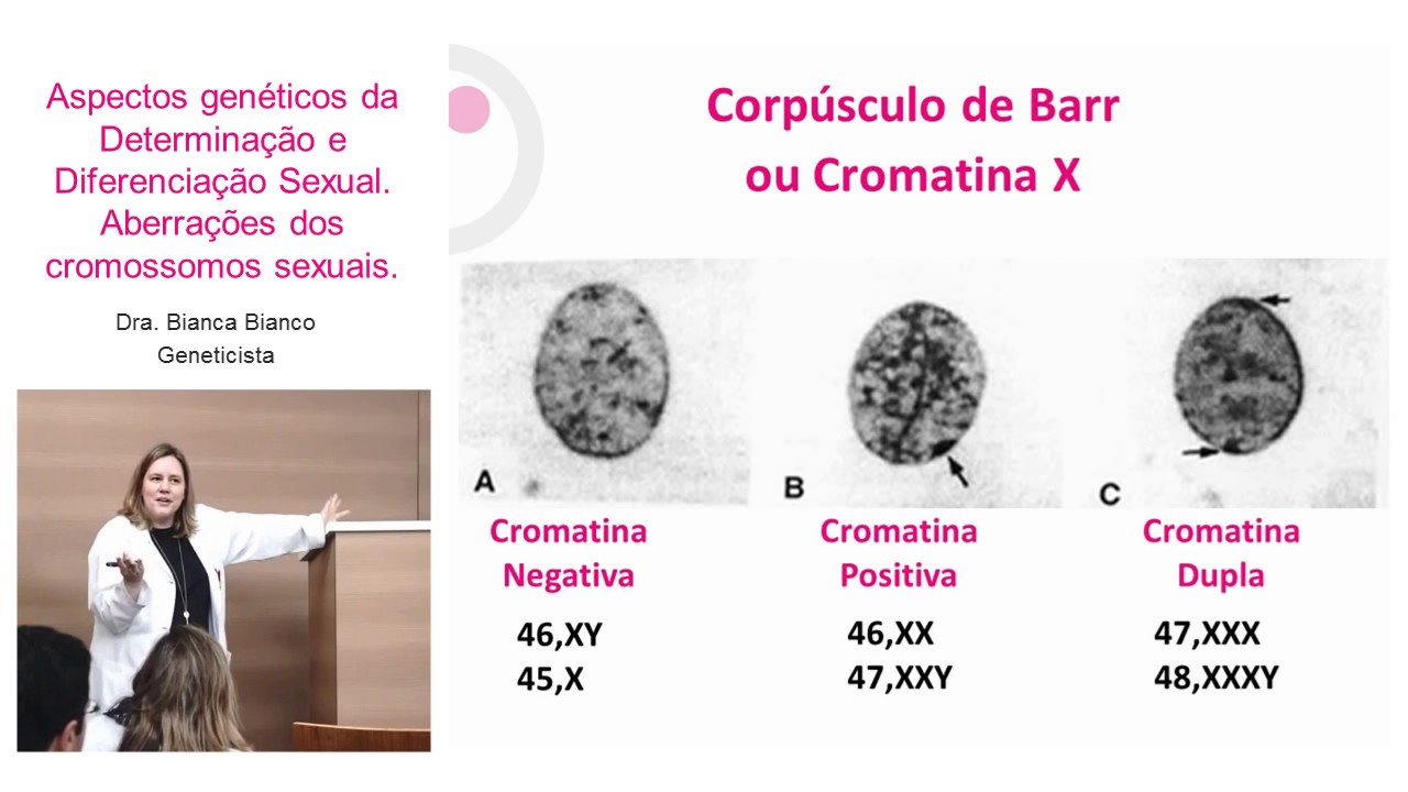 Aspectos Genéticos da Determinação e Diferenciação Sexual Parte I - Reprodução Humana