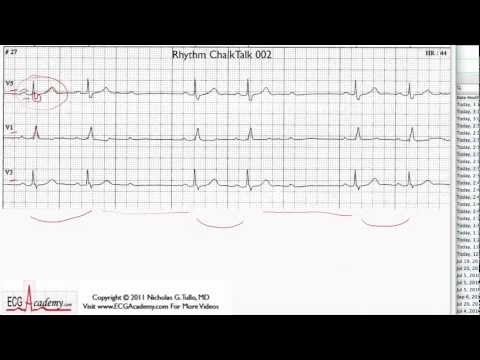 Interpretacja EKG - Poziom Podstawowy, Cz.2