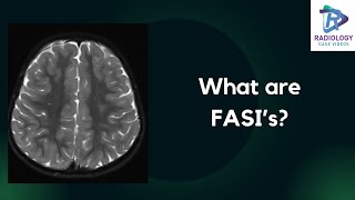 What are FASI's? #Dr.UmamaheswaraReddy.V