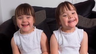 Pravdpodobnost dvojat s Downovm syndromem je 1 ku milinu