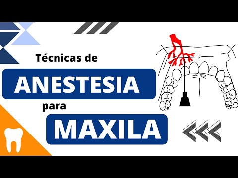 Understand the anesthetic techniques for the maxilla