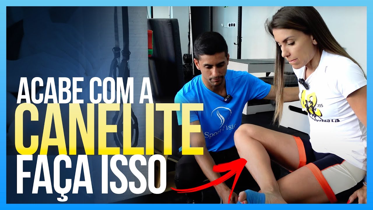 Como RESOLVER A CANELITE de vez! Faça VOCÊ MESMO e acabe com as DORES NA CANELA