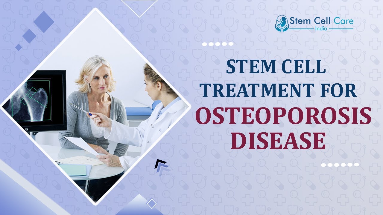 Best Treatment For Osteoporosis | Stem Cell Center In Delhi For Osteoporosis | Exosome Therapy 