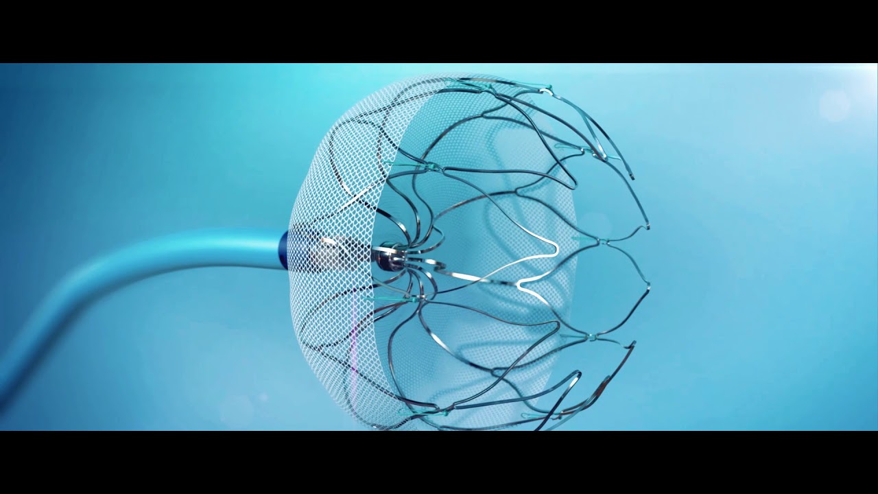 Watchman Implant Procedure CVG Cares CVG Cares