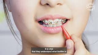GBT IMPROVES ORTHODONTIC TX COMPLIANCE I GBT Microlearning with Dr. Hanan Abdalla