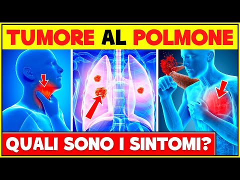 5 Segni e Sintomi Di Un Tumore Ai Polmoni | Non Ignorare Questi Sintomi!