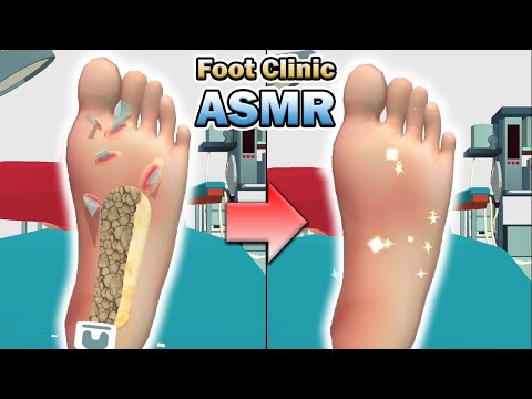 Foot Clinic - ASMR Feet Care (by Crazy Labs) IOS Gameplay Video (HD)2021 - YouTube