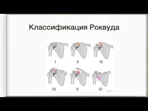 19. Повреждения лопатки, переломы и вывихи ключицы.