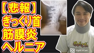 俺も同じ事お医者さんに言われたことあるわラグビーとかされてました?て聞かれた。恰幅が良いから尚更 - 【悲報】加藤純一、ぎっくり首×筋膜炎×ヘルニアのトリプル役満。【2023/09/26】