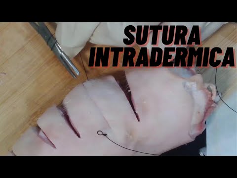 COMO HACER UNA SUTURA INTRADERMICA