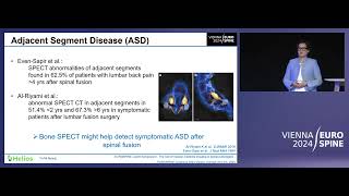 Nuclear medicine imaging in revision spine surgeries | Ryang | EUROSPINE 2024