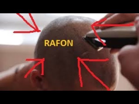 Rafonix | Goli Głowe | Zobacz |  Krwawił