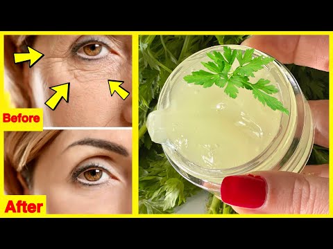 , title : 'Parsley EYE Cream ! Remove Dark Circles, Wrinkles & Puffiness From Night to Morning ! Beauty DIY'