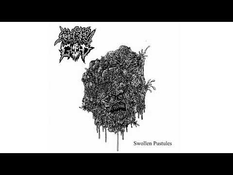 Gore God - Swollen Pustules (Full Demo)