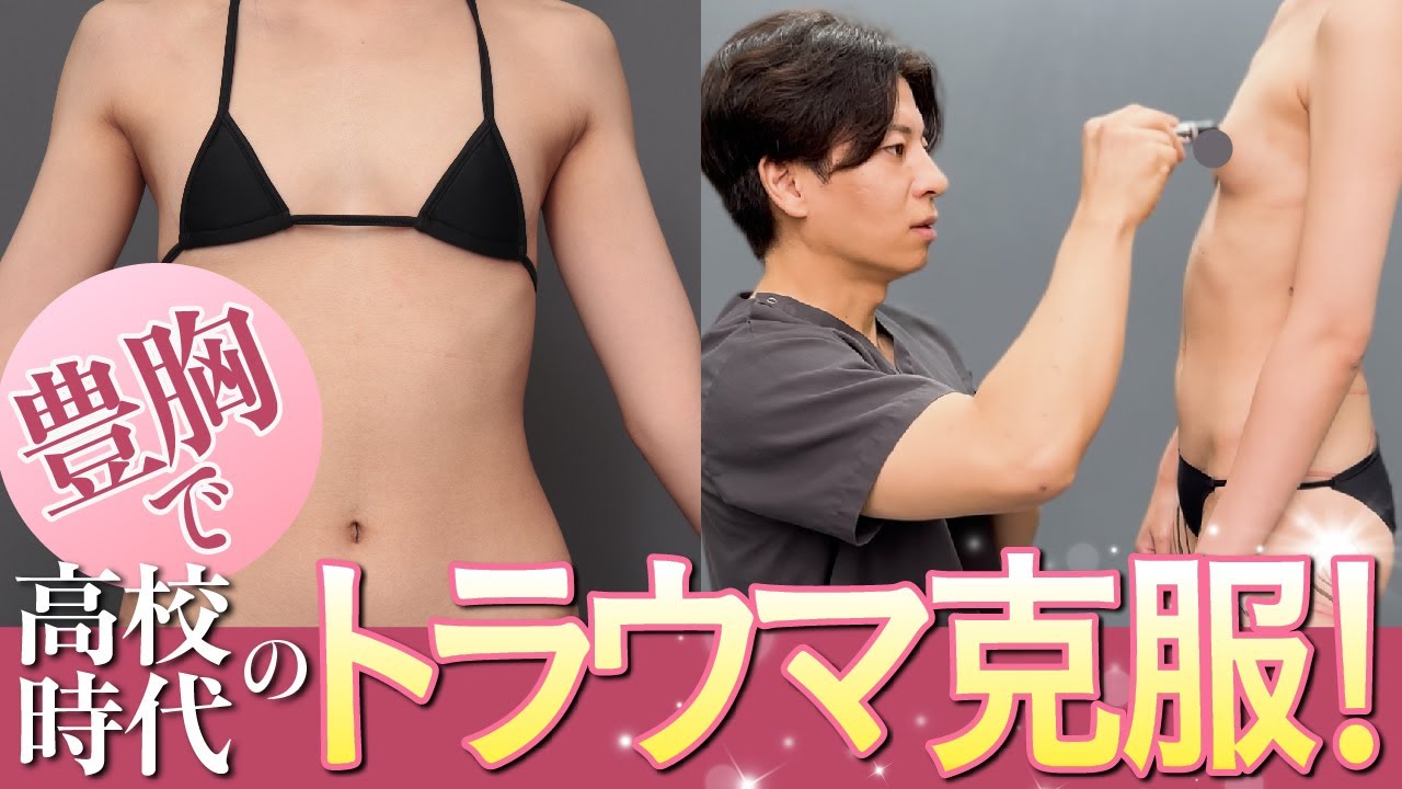高校時代の胸の悩みを脂肪豊胸で解消