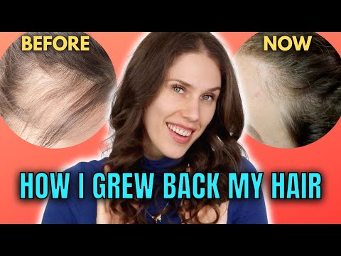 10 Best & Worst Hair Growth Treatments That I've Tried...