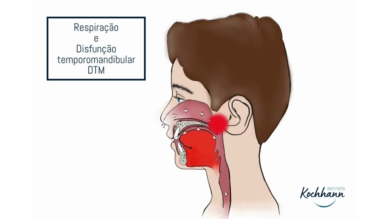 Alteração da respiração nasal para bucal e consequências no corpo todo ...