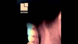 Toothgrinder - Sectioned