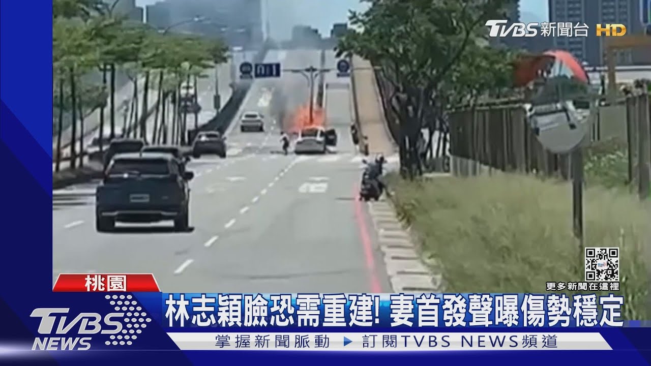 林志穎車禍臉部重創傳鈦金屬重建! 陳若儀首發聲「狀況穩定」別信謠言