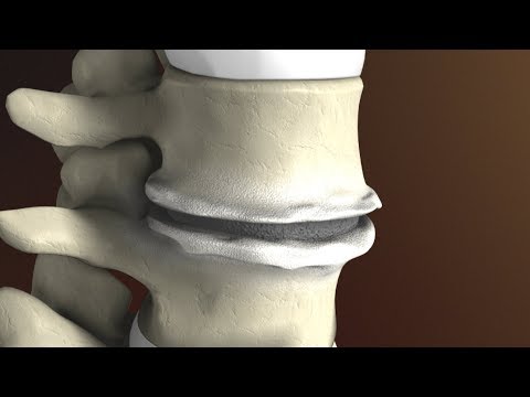 Durerea articulațiilor provoacă tratament