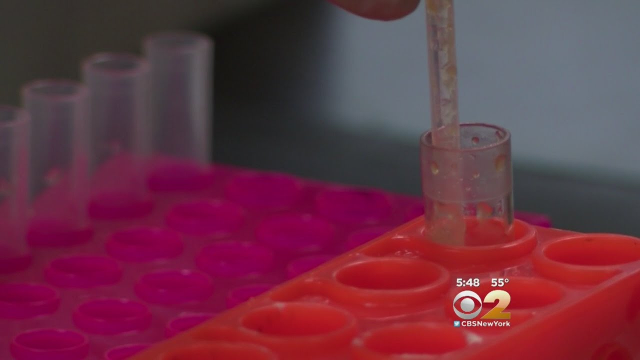 Dr. Max Gomez: Concussion Blood Tests