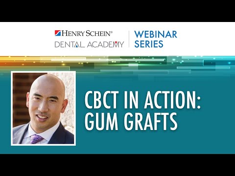 CBCT in Action: Gum Grafts