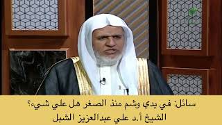 صورة أ.د. علي الشبل | في يدي وشم منذ الصغر هل علي شيء؟