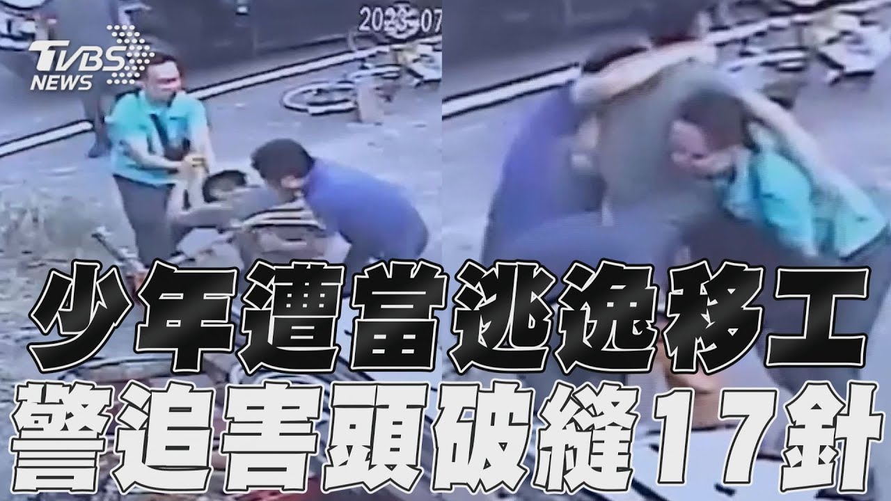 便衣警認錯人！學生「以為綁架」死命掙扎　撞破臉衰縫17針