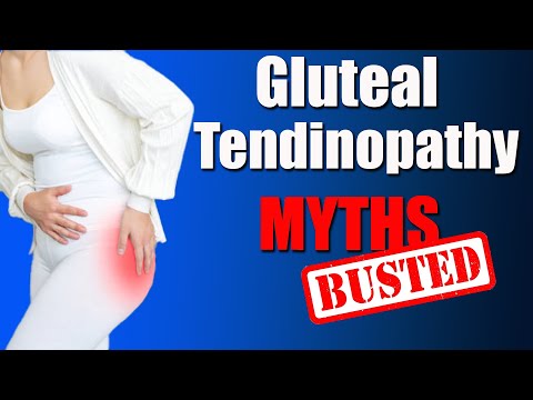 Gluteal Tendonitis/Tendinopathy: Myths vs. Facts About Trochanteric Hip Pain