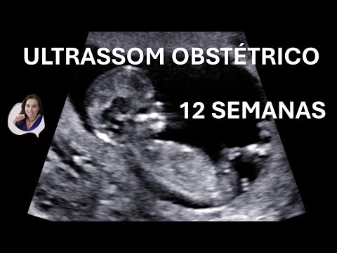 12 weeks of gestation ultrasound (video)