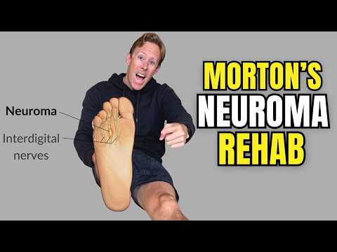 Anatomie & Behandlungswissen Videos – Interaktives Nachschlagewerk für Physio, Massage, Therapie 57 How to Treat Morton’s Neuroma Naturally (Best Exercises for Nerve Pain)