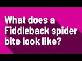 What does a Fiddleback spider bite look like?