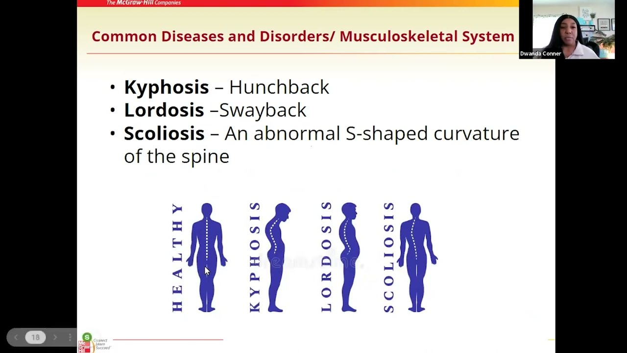 04 Skeletal and Muscular systems Common Diseases and Disorders Musculoskeletal System