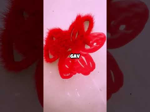 Farfar Hade Ett Mänskligt Öra På Vinden I 50 År