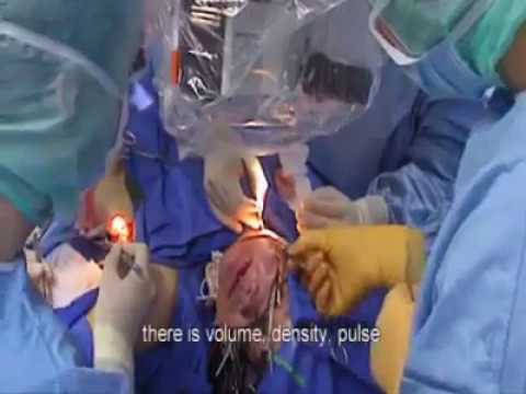 Quale testo elementare per posti di pigmentary Macchie scure su una faccia dopo posti