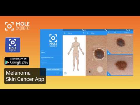 Molexplore “Skin Cancer App” Video