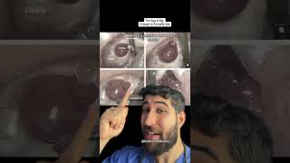 Download lagu The Human Egg is Bigger Than You Think #pain mp3