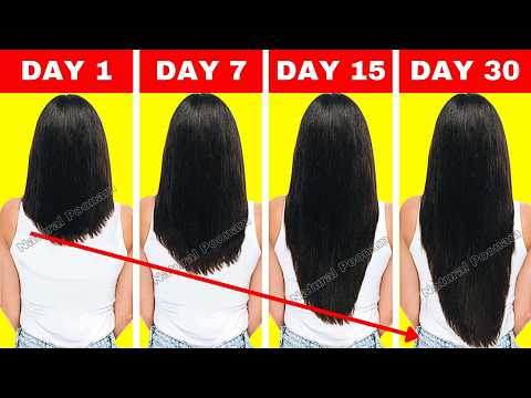 Double Hair Growth ||30 Days Challenge 2026: The World's Best Way to Grow Long Hair faster !!!