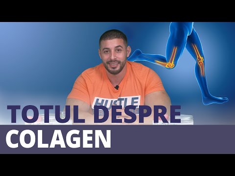 funcionarea de la varicoza sterlitamak bai din maini varicoase
