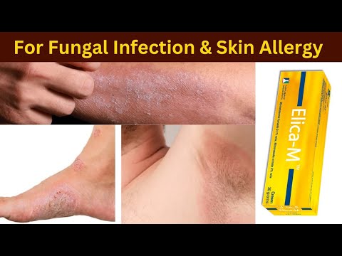 Elica m cream | elica-m cream review | How to use | benefits | miconazole cream how to apply