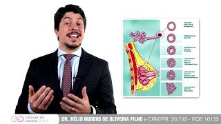 CARCINOMA DUCTAL INVASIVO.