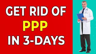 How To Get Rid Of PPP In 3 Days | 6 PPP Myths Exposed