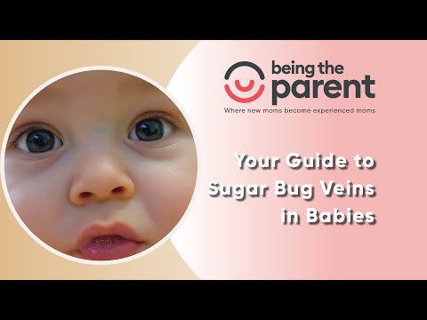 Sugar Bug Vein