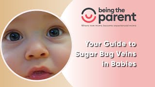 All About Sugar Bug Veins in Babies